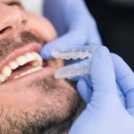 How to take care of your Invisalign
