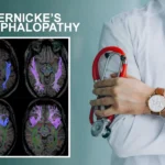 Wernicke’s Encephalopathy